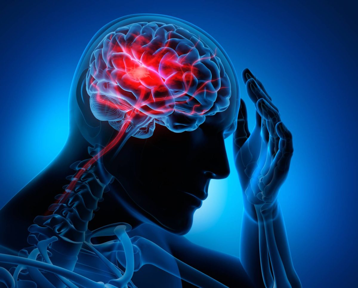 تعتبر السكتة الدماغية أحد الحالات المرضية التي يعالجها دكتور المخ و الأعصاب